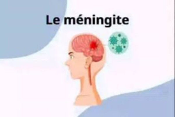 பிரான்சிலும் மூளைக்காய்ச்சலுடன் தொடர்புடைய ஒருவர் மருத்துவமனையில்!!