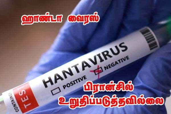 இன்று பிரான்சில் உள்ள அனைத்து ஹொண்டா வைரஸ் தொடர்பு நபர்களும் பரிசோதனை!