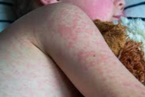  ஆயிரக்கணக்கான அவுஸ்திரேலியர்கள் ஆபத்து... அபாய எச்சரிக்கை விடுப்பு