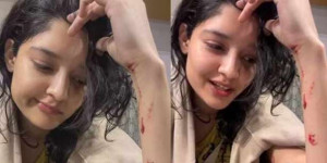 'தலைவர் 170' படப்பிடிப்பில் பிரபல நடிகை காயம்.. 