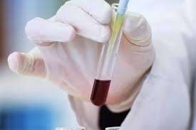 உலகில் ஒரே ஒருவருக்கு மட்டுமே உள்ள புதிய ரத்த வகை - எப்படி கண்டுபிடிக்கப்பட்டது?