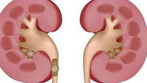 சிறுநீரகத்தை ஆரோக்கியமாக வைத்திருக்க உதவும் உணவுகள் 