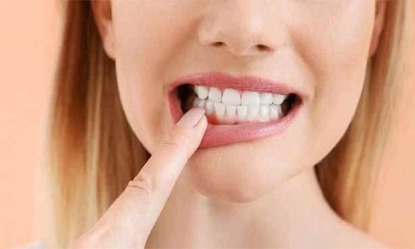 பற்களை பாதுகாக்க எளிய வழிகள்