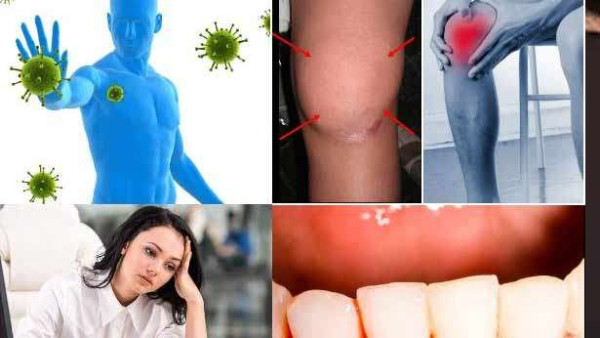 வைட்டமின்-சி  குறைபாட்டை வெளிப்படுத்தும்  அறிகுறிகள் பற்றி தெரியுமா?