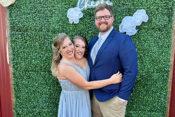 ஒட்டிப்பிறந்த இரட்டையரின் கனவு திருமணம்! 3 ஆண்டுகளுக்கு பிறகு வெளியான ரகசியம்