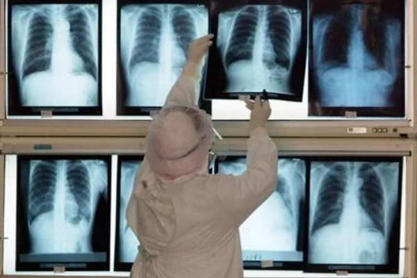 மருத்துவத் துறையில் விரிவடைந்து வரும் செயற்கை நுண்ணறிவு தொழில்நுட்பம்