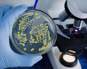  ஜப்பானில்  அதிதீவிரமாக பரவும் பக்டீரியா தொற்று - ஐந்து கர்ப்பிணிகள் பலி