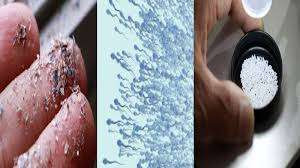 அமெரிக்காவில் மனிதருக்கு பரவும் பறவைக்காய்ச்சல்- அரசாங்கத்தின் அதிரடி