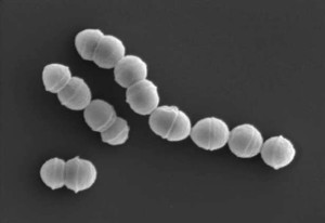 ஜப்பானில் சதை உண்ணும் பக்டீரியா தொற்று -  பீதியில்  மக்கள்...!