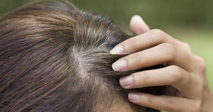 இளநரையிலிருந்து மீள்வது எப்படி?