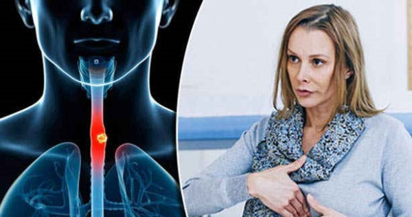 நெஞ்செரிச்சல் அலட்சியம் வேண்டாம்